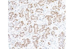 Immunohistochemistry (IHC) image for anti-Forkhead Box P1 (FOXP1) (AA 627-677) antibody (ABIN7454010)