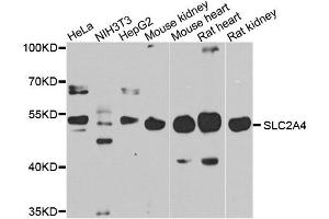Western blot analysis of extracts of various cell lines, using SLC2A4 antibody. (GLUT4 Antikörper  (C-Term))