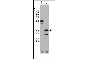Image no. 1 for anti-Zic Family Member 4 (ZIC4) (C-Term) antibody (ABIN357859) (ZIC4 Antikörper  (C-Term))