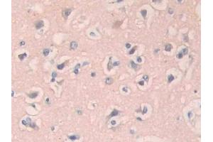 Immunohistochemistry (IHC) image for anti-Interleukin 1 Receptor, Type I (IL1R1) (AA 226-318) antibody (ABIN7437953)
