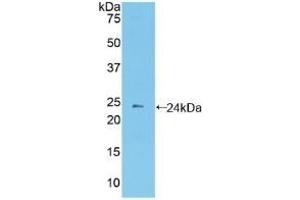 Detection of Recombinant PCDHb2, Mouse using Polyclonal Antibody to Protocadherin Beta 2 (PCDHb2) (PCDHb2 Antikörper  (AA 79-253))