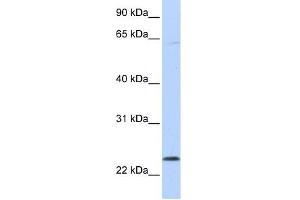 CHAC1 antibody used at 1 ug/ml to detect target protein. (CHAC1 Antikörper)
