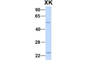 Host:  Rabbit  Target Name:  CHAD  Sample Type:  Human Adult Placenta  Antibody Dilution:  1. (Membrane transport protein XK (XK) (N-Term) Antikörper)