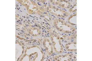Immunohistochemistry of paraffin-embedded human kidney using ATP6AP1 antibody at dilution of 1:200 (x400 lens). (ATP6AP1 Antikörper)