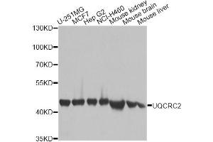 Western blot analysis of extracts of various cell lines, using UQCRC2 antibody. (UQCRC2 Antikörper)