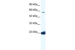 Western Blotting (WB) image for anti-DEAD (Asp-Glu-Ala-Asp) Box Polypeptide 55 (DDX55) antibody (ABIN2461357) (DDX55 Antikörper)