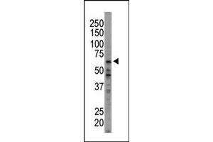Western blot analysis of anti-HRI Pab (ABIN392638 and ABIN2842142) in  cell lysate. (EIF2AK1 Antikörper  (N-Term))