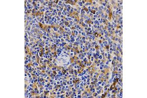 Immunohistochemistry of paraffin-embedded rat spleen using CDK20 antibody (ABIN5971446) at dilution of 1/200 (40x lens). (CCRK Antikörper)