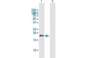 Western Blot analysis of CSF2 expression in transfected 293T cell line by CSF2 MaxPab polyclonal antibody. (GM-CSF Antikörper  (AA 1-144))
