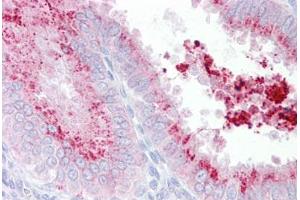 Anti-KIAA1324 antibody IHC staining of human uterus.