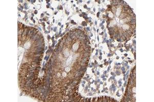 Cytochrome c Antibody for IHC in human colorectal tissue (Cytochrome C Antikörper)