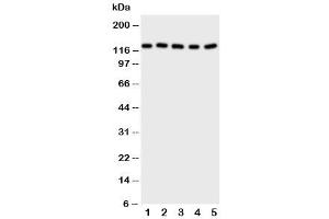 Western blot testing of Desmoglein 2 antibody and Lane 1:  HT1080 (Desmoglein 2 Antikörper  (C-Term))