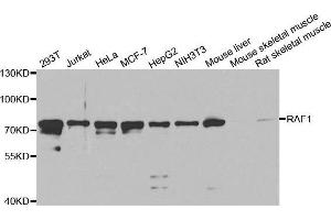 Western Blotting (WB) image for anti-V-Raf-1 Murine Leukemia Viral Oncogene Homolog 1 (RAF1) (AA 190-350) antibody (ABIN3020713)