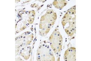Immunohistochemistry of paraffin-embedded human stomach using HNRNPL antibody. (HNRNPL Antikörper  (AA 282-589))