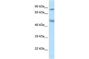 WB Suggested Anti-Zfp90 Antibody   Titration: 1. (ZNF90 Antikörper  (N-Term))