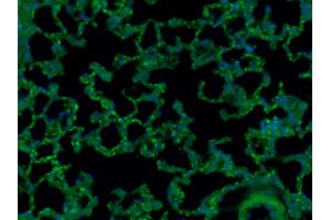 Paraformaldehyde-fixed, paraffin embedded (Mouse lung), Antigen retrieval by boiling in sodium citrate buffer (pH6. (CD8 Antikörper  (AA 51-150) (Alexa Fluor 488))