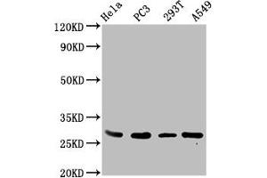 Western Blot Positive WB detected in: Hela whole cell lysate, PC-3 whole cell lysate, 293T whole cell lysate, A549 whole cell lysate All lanes: EFHD1 antibody at 3. (EFHD1 Antikörper  (AA 15-72))