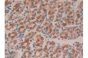 DAB staining on IHC-P; Samples: Human Stomach Tissue (Intrinsic Factor Antikörper  (AA 198-413))