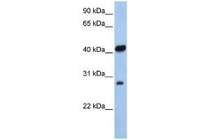 Human 721_B; WB Suggested Anti-ZFAND3 Antibody Titration: 0. (ZFAND3 Antikörper  (N-Term))