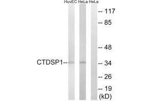 Western blot analysis of extracts from HUVEC cells and HeLa cells, using CTDSP1 antibody. (CTDSP1 Antikörper  (N-Term))