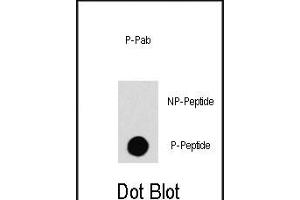 Dot blot analysis of anti-RAF1-p Phospho-specific Pab (R) on nitrocellulose membrane.