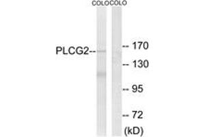 Western blot analysis of extracts from COLO205 cells, using PLCG2 (Ab-753) Antibody. (Phospholipase C gamma 2 Antikörper  (AA 721-770))