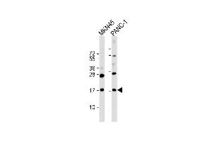 All lanes : Anti-FB Antibody (C-Term) at 1:2000 dilution Lane 1: MKN45 whole cell lysate Lane 2: NC-1 whole cell lysate Lysates/proteins at 20 μg per lane. (FAM159B Antikörper  (AA 121-154))