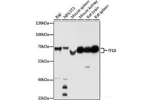 Western blot analysis of extracts of various cell lines using TFEB Polyclonal Antibody at dilution of 1:1000. (TFEB Antikörper)