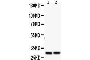 Anti- Bcl2A1 antibody, Western blotting All lanes: Anti Bcl2A1 at 0.