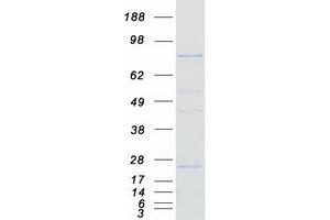 Western Blotting (WB) image for Carnitine Palmitoyltransferase 1C (CPT1C) (Transcript Variant 2) protein (Myc-DYKDDDDK Tag) (ABIN2712539)