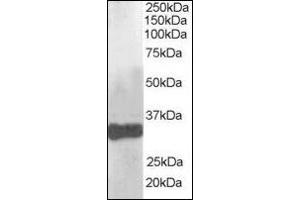 Image no. 2 for anti-Claudin 14 (CLDN14) (C-Term) antibody (ABIN372842) (CLDN14 Antikörper  (C-Term))