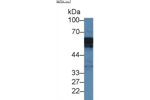 Detection of ANXA11 in Mouse Placenta lysate using Polyclonal Antibody to Annexin A11 (ANXA11) (Annexin A11 Antikörper  (AA 1-505))