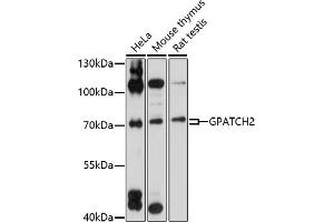 Western blot analysis of extracts of various cell lines, using GP antibody (ABIN7267287) at 1:1000 dilution. (GPATCH2 Antikörper  (AA 1-250))