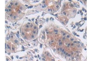Immunohistochemistry (IHC) image for anti-Leukemia Inhibitory Factor (LIF) (AA 2-201) antibody (ABIN7430882)