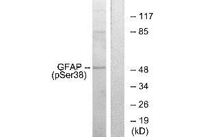 Western blot analysis of extracts from HeLa cells, using GFAP (Phospho-Ser38) antibody. (GFAP Antikörper  (pSer38))