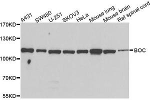 Western blot analysis of extracts of various cells, using BOC antibody. (BOC Antikörper)