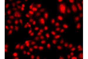 Immunofluorescence analysis of A549 cells using TEAD3 antibody. (TEAD3 Antikörper)