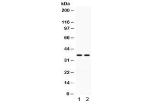Western blot testing of human 1) HeLa and 2) K562 cell lysate with CD58 antibody. (CD58 Antikörper)