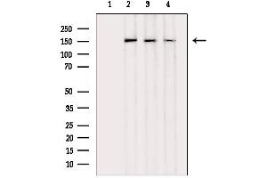 Western blot analysis of lysates from various samples, using Insulin Receptor alpha Mouse Monoclonal Antibody.