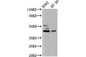 Western Blot Positive WB detected in: K562 whole cell lysate, HT29 whole cell lysate All lanes: B3GNT6 antibody at 10 μg/mL Secondary Goat polyclonal to rabbit IgG at 1/50000 dilution Predicted band size: 43, 30 kDa Observed band size: 43 kDa (B3GNT6 Antikörper  (AA 251-345))