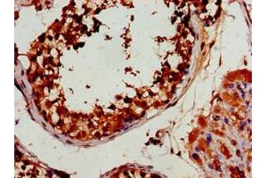 Immunohistochemistry of paraffin-embedded human testis tissue using ABIN7165627 at dilution of 1:100 (HEXIM2 Antikörper  (AA 1-286))