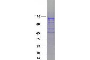 Western Blotting (WB) image for Schlafen Family Member 5 (SLFN5) protein (Myc-DYKDDDDK Tag) (ABIN2732191)