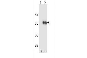 Western Blotting (WB) image for anti-Aldehyde Dehydrogenase 3 Family, Member B1 (ALDH3B1) (AA 334-360) antibody (ABIN652651)