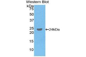 Western Blotting (WB) image for anti-Fc Fragment of IgG, Low Affinity IIIb, Receptor (CD16b) (FCGR3B) (AA 24-203) antibody (ABIN1858834) (FCGR3B Antikörper  (AA 24-203))