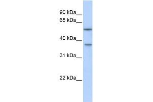 WB Suggested Anti-RAB40B Antibody Titration: 0. (RAB40B Antikörper  (Middle Region))