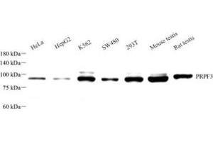 anti-PRP3 Pre-mRNA Processing Factor 3 Homolog (PRPF3) antibody