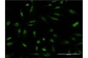 Immunofluorescence of monoclonal antibody to DUSP1 on HeLa cell.