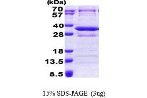 SDS-PAGE (SDS) image for CCR4-NOT Transcription Complex, Subunit 8 (CNOT8) (AA 1-292) protein (His tag) (ABIN5853036) (CNOT8 Protein (AA 1-292) (His tag))