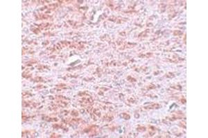 Immunohistochemistry (IHC) image for anti-Caudal Type Homeobox 2 (CDX2) (C-Term) antibody (ABIN1030331) (CDX2 Antikörper  (C-Term))