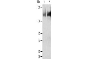 Western Blotting (WB) image for anti-Transient Receptor Potential Cation Channel, Subfamily M, Member 6 (TRPM6) antibody (ABIN2427463) (TRPM6 Antikörper)